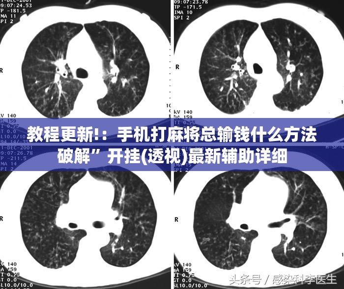 教程更新!：手机打麻将总输钱什么方法破解”开挂(透视)最新辅助详细