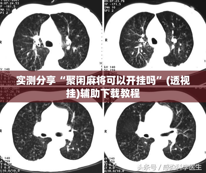 实测分享“聚闲麻将可以开挂吗”(透视挂)辅助下载教程