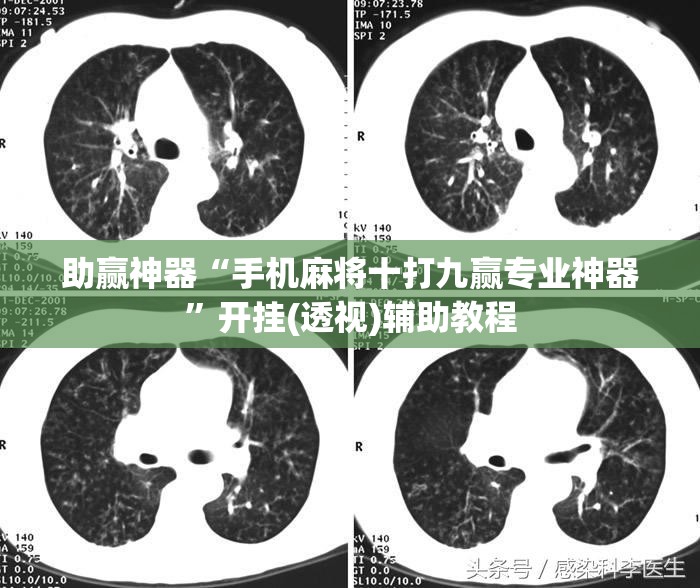 助赢神器“手机麻将十打九赢专业神器”开挂(透视)辅助教程